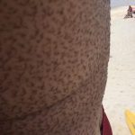 manchas-piel-300×300