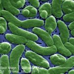 VIBRO VULNIFICUS